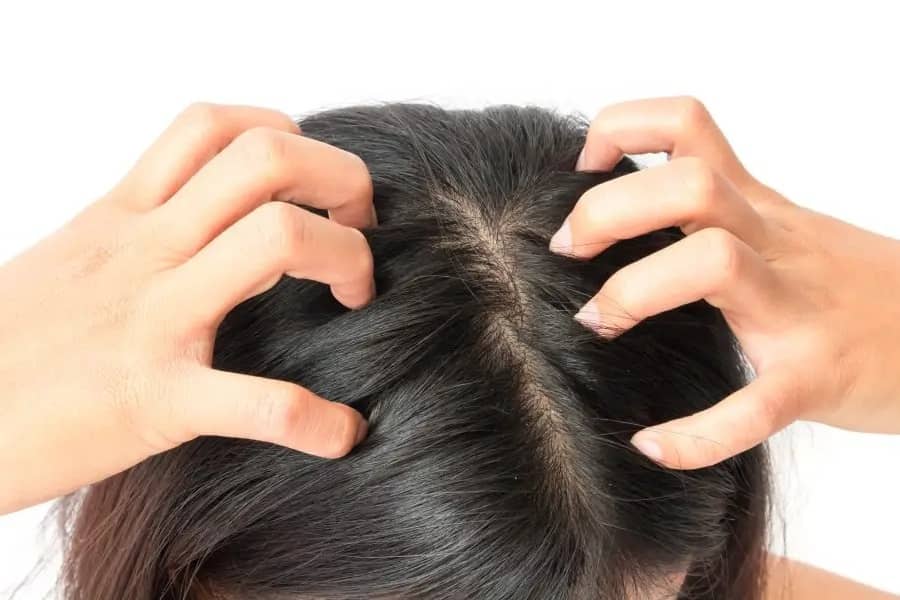 How To Determine If My Scalp Is Dry Or Oily